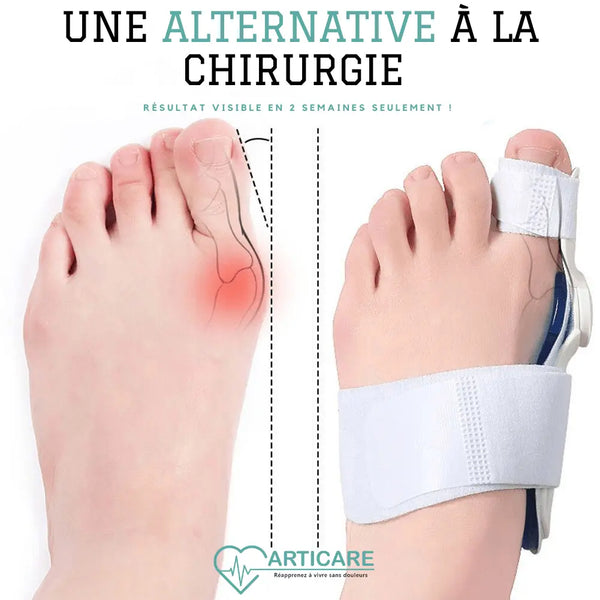 Correcteur Hallux Valgus  | ArtiCare™ ArtiCare