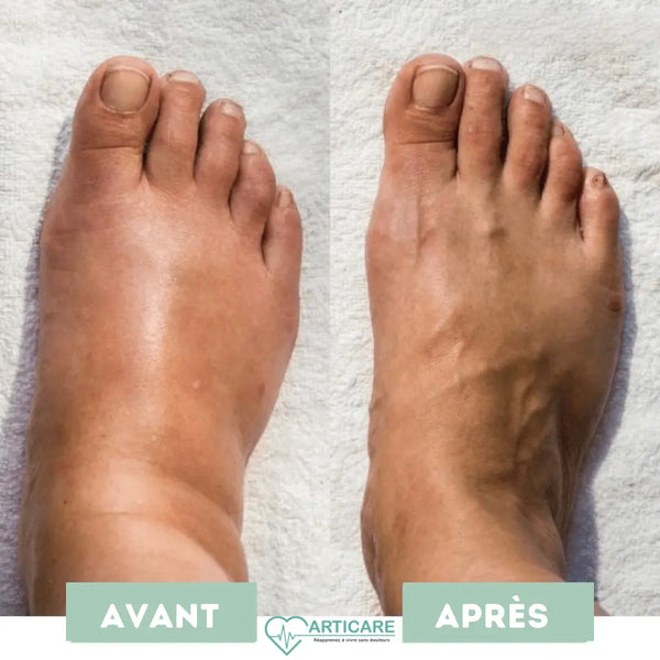 Mass'Pieds Revitalisant EMS | ArtiCare™ ArtiCare